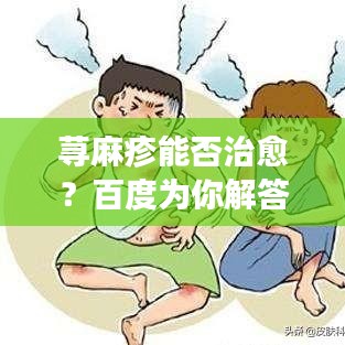 荨麻疹能否治愈？百度为你解答！